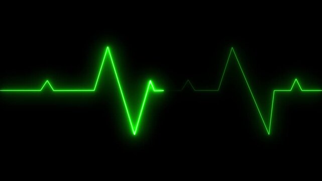 Green Neon Heartbeat Line Graph on a Black Background Indicating Health or Normalcy electrocardiogram