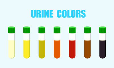 Urine color test on background. the colors of urine tell us about health.  