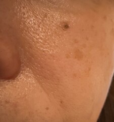 50代女性のリアルな肌。シミ、肝斑、毛穴、シワ、たるみ。