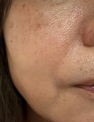 50代女性のリアルな肌。シミ、肝斑、毛穴、シワ、たるみ。