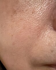 50代の日本人女性のリアルな肌。シミ、肝斑、毛穴、シワ、たるみ。