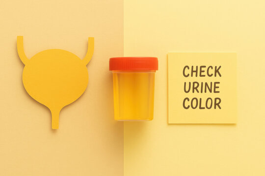 Urine test for color check and health monitoring concept. paper cut bladder shape, container, and sticky note on yellow background for urology and hydration awareness