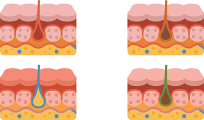 Skin cross section illustration, hair follicle anatomy vector, epidermis dermis diagram, human skin layers graphic, dermatology medical artwork