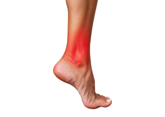 Inflamed leg(Turns slightly red). isolated on transparent or white background