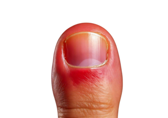 Inflamed toe (Turns slightly red) isolated on transparent or white background
