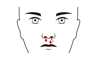 Nosebleed medical poster