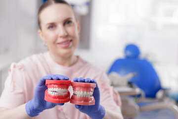 Closeup invisalign aligner or system of braces for straightening teeth on dental models in clinic,...