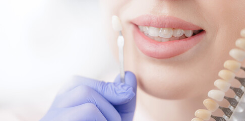 Female caucasian adult undergoing dental shade matching for perfect smile, dentistry banner
