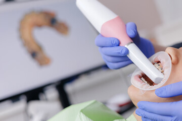 Dental 3d scanning procedure on young patient in dental clinic