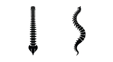 A comparison of healthy and curved spinal columns anatomical illustration