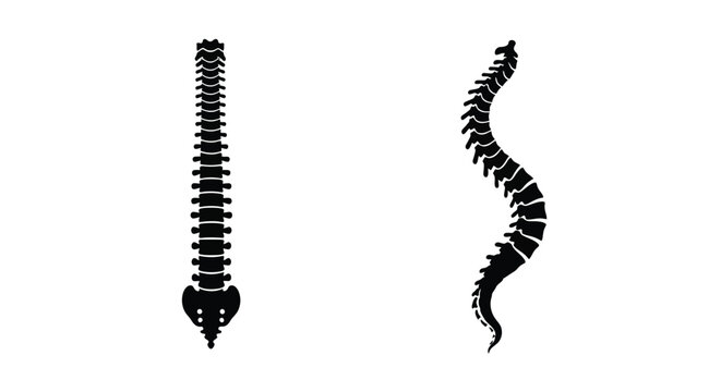 A comparison of healthy and curved spinal columns anatomical illustration