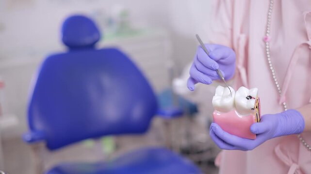 Female dental professional demonstrating treatment of caries and pulpitis of nerve canal of tooth model in clinic, sunlight.