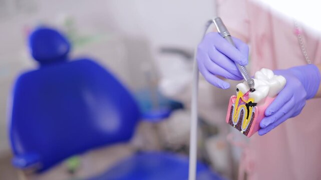 Dental professional demonstrating tooth treatment of caries and pulpitis of nerve canal on model in clinic.