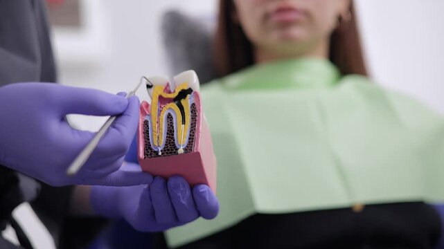 Female patient learning about caries and pulpitis of nerve canal of tooth model in clinic and structure at dental clinic.