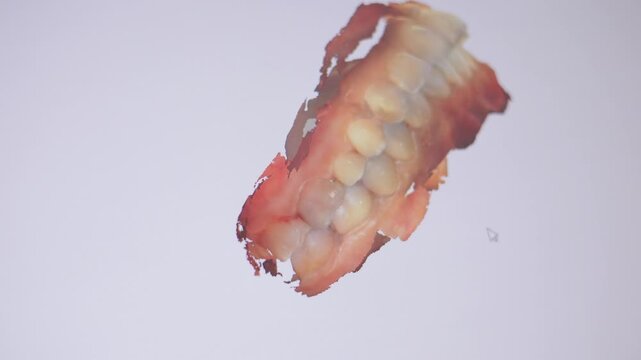 Dental 3d scanning procedure on young patient in dental clinic.