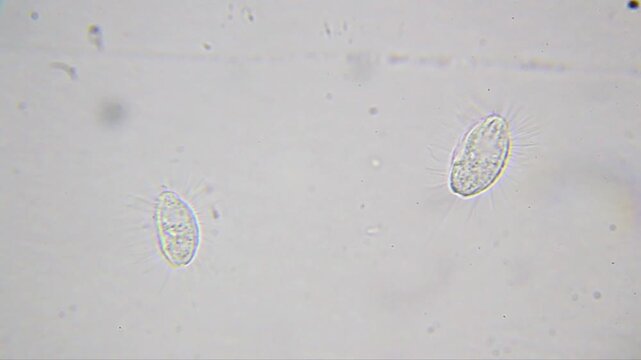 Two spiky single-celled microbes resembling tiny hedgehogs at 2000x (brightfield, oil immersion)