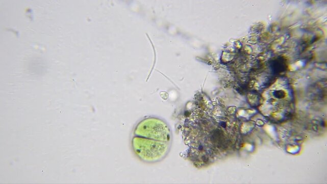 Cyanobacteria with spiral-shaped bacterium and flagellated microbe near sand at 2000x (brightfield, oil immersion)