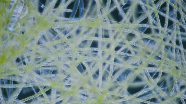 Filamentous green algae under microscope