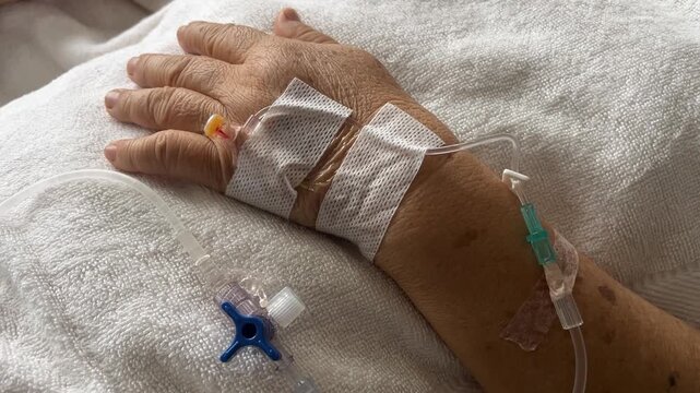 Infusion Therapy: A close-up view of a patient's hand with an IV drip, highlighting a moment of vulnerability within the realm of healthcare and medical treatment.