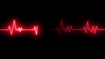 Vital signs on medical monitors, looping 4K of neon red electrocardiogram (ECG) graph lines on black background. Medical concept showing heart rate. - Powered by Adobe