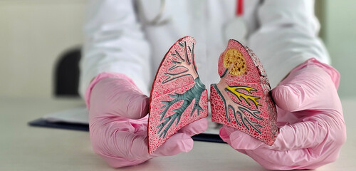 Doctor with smoker and normal lung anatomy for disease. Lung cancer asthma and chronic obstructive pulmonary disease concept closeup