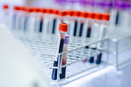 Blood collection tubes for collecting all blood groups using tube holders in clinical laboratories.
