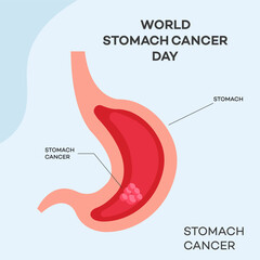 World Stomach Cancer Day Illustration  Medical Awareness Campaign