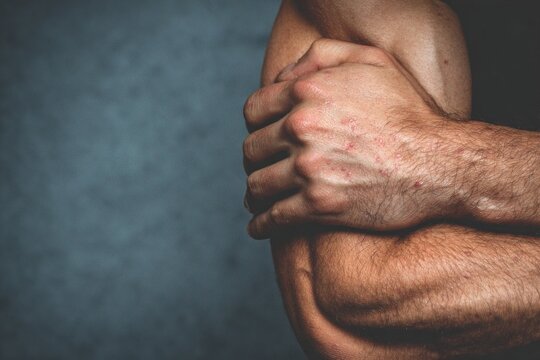 Histamine Itch Fest: Histamine triggers an itch fest, causing muscles to twitch and scratch in response to an irritating stimulus.