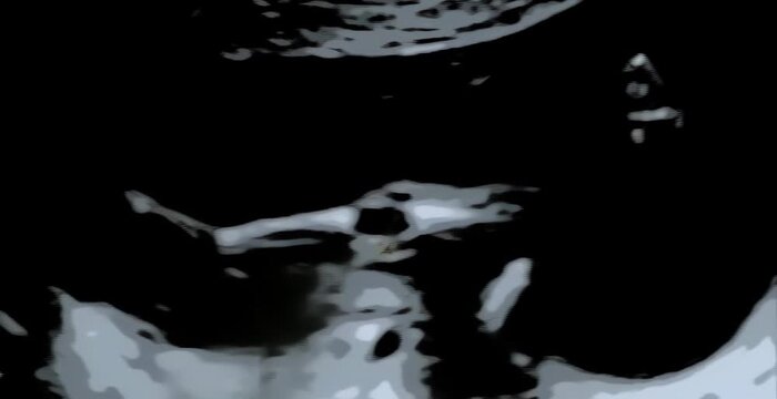 Detailed ultrasound scan showing developing baby inside the womb during routine medical examination