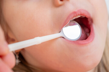 dentist, doctor examines oral cavity of small patient, uses mouth mirror, closeup baby teeth child, concept pediatric dentistry, dental treatment, correction of occlusion, oral care, caries prevention
