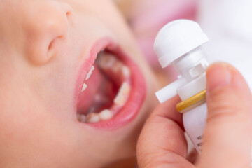 Closeup child's open mouth receiving aerosol spray from hand-held bottle, suggesting treatment for sore throat, tonsillitis, asthma, or allergy quick relief, young patient receiving medicated spray