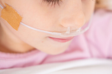 child lying with nasal cannula supplying oxygen, eyes closed, suggesting illness, recovery, or treatment for respiratory condition, Pediatric medical care, oxygen therapy via nasal cannula in hospital