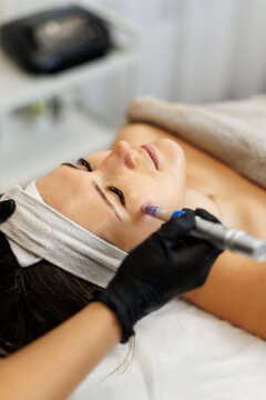 A close-up of a woman receiving microneedling therapy with a dermapen device on her cheek. The treatment is performed by a gloved professional in a serene spa setting