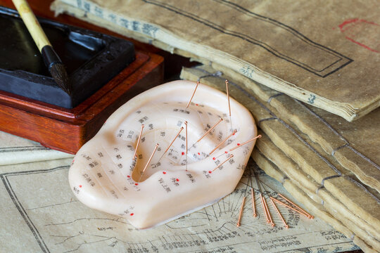 Ear model and needle for ear acupuncture with ancient medicine books at the background (Translation: all the characters are no text, but individual names of each acupuncture point.)