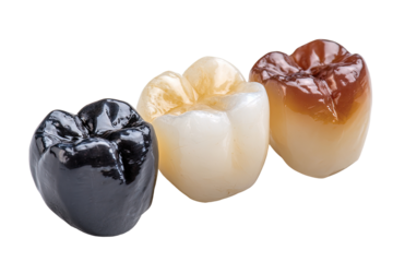 Three dental crowns, varying in shade from black to light brown to dark brown,  show a range of color options for restorative dentistry.  Close-up view, isolated on black