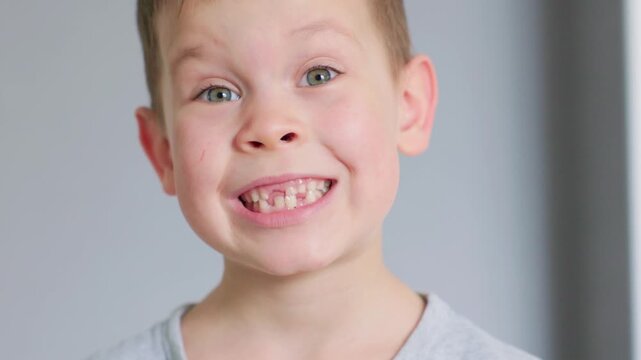 A truly joyful child smiling widely, showcasing pure excitement and missing teeth, capturing blissful happiness