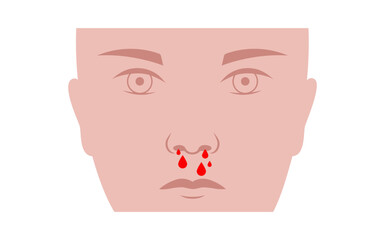 Nosebleed medical poster