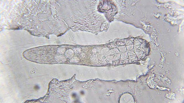 Large Demodex folliculorum with visible eggs and active movement at 400x (brightfield)