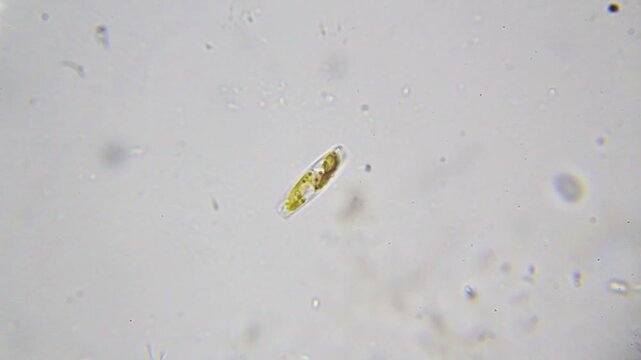 Diatom algae moving due to Brownian motion, with a single-celled organism swimming nearby. Magnification 2000x with immersion oil, brightfield microscopy
