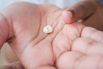 Child shows off a lost tooth in their palm