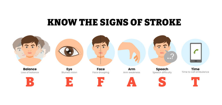 Befast infographic diagram poster. Know signs of stroke symptoms. First action for stroke. Befast Labeled balance, eye, face, arm, speech, time. Medical science educational illustration.