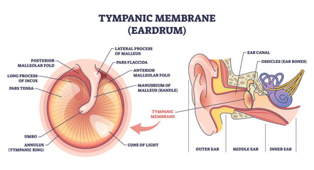 Tympanic membrane brief diagram shows eardrum anatomy and sound path with malleus handle, ear canal, and ossicles highlighted for teaching and diagnosis. Outline diagram © VectorMine