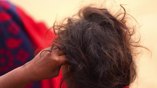 Poor Child Scratching Hair and Back &ndash; Real-Life Close-Up