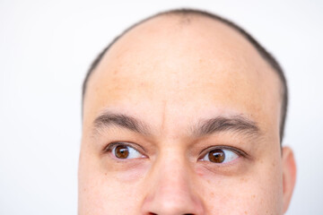 Closeup portrait man with brown eyes and shaved head, white background, male baldness and growing need professional hair restoration, natural skin texture, intensity glance, human forehead