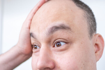 Close-up brown-eyed short-haired man holding head in pain, suffering from headache or stress, concept tension, human emotion, stress thinking, mental health, fatigue, and emotional exhaustion