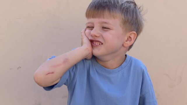 Boy in a good mood smiles with scratched hand and wound on his elbow outdoors. Child smiles and raises hand to reveal scraped palm and elbow after fall. Healthcare tutorials, pediatric-care references