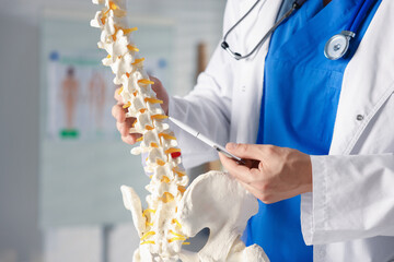 Doctor with human spine model in hospital, closeup
