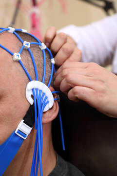 Electroencephalography (EEG) procedure. A noninvasive medical test that measures the brain's electrical activity.