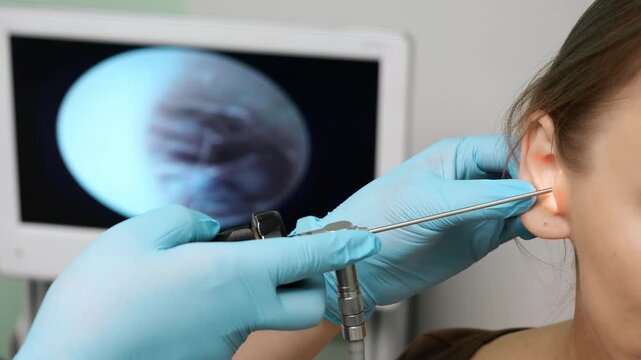 Close up of ENT doctor reviewing ear endoscopy image on medical monitor during examination of female patient in modern clinic, diagnostic evaluation and healthcare checkup.
