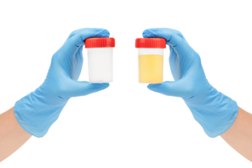 Hands in blue gloves holding empty urine sample container and urine test tube isolated on white background